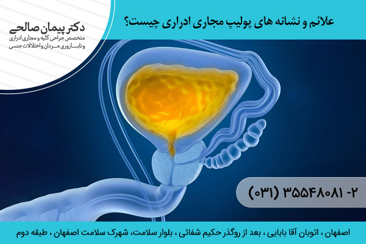 علائم و نشانه های پولیپ مجاری ادراری