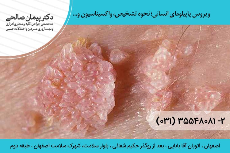 ویروس پاپیلومای انسانی