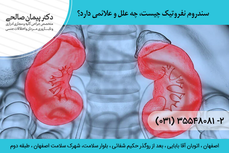 سندروم نفروتیک