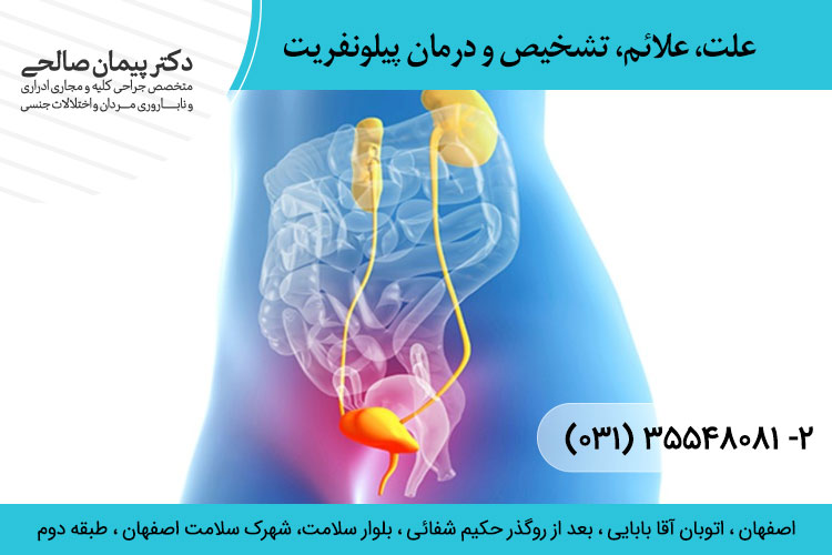 درمان پیلونفریت