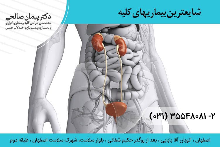 شایعترین بیماریهای کلیه