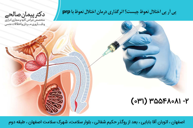 برای رفع اختلال نعوظ 