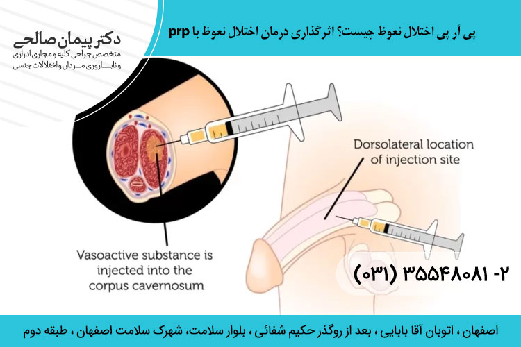پی آر پی اختلال نعوظ چیست؟
