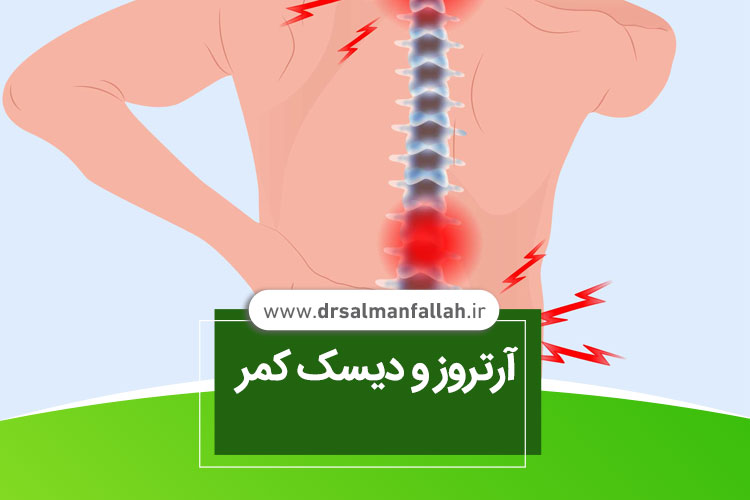 درمان آرتروز ستون مهرها