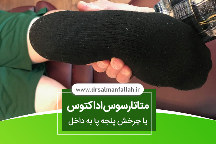 متاتارسوس اداکتوس