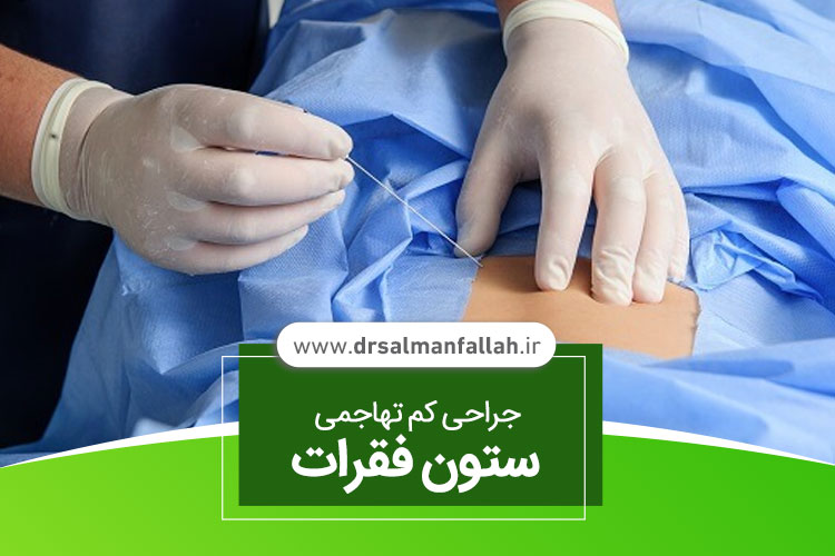 جراحی کم تهاجمی ستون فقرات