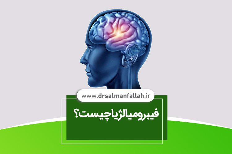 فیبرومیالژیا