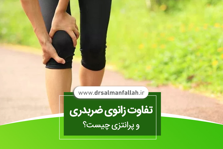 تفاوت زانوی ضربدری و پرانتزی