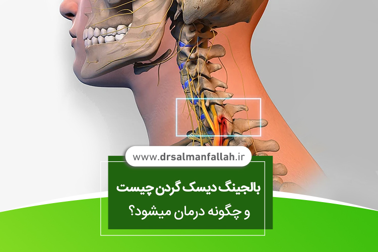 بالجینگ دیسک گردن