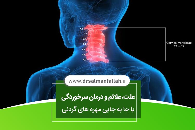 جا به جایی مهره های گردنی