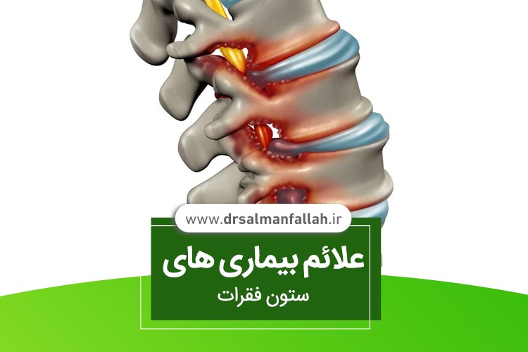 علائم بیماری های ستون فقرات