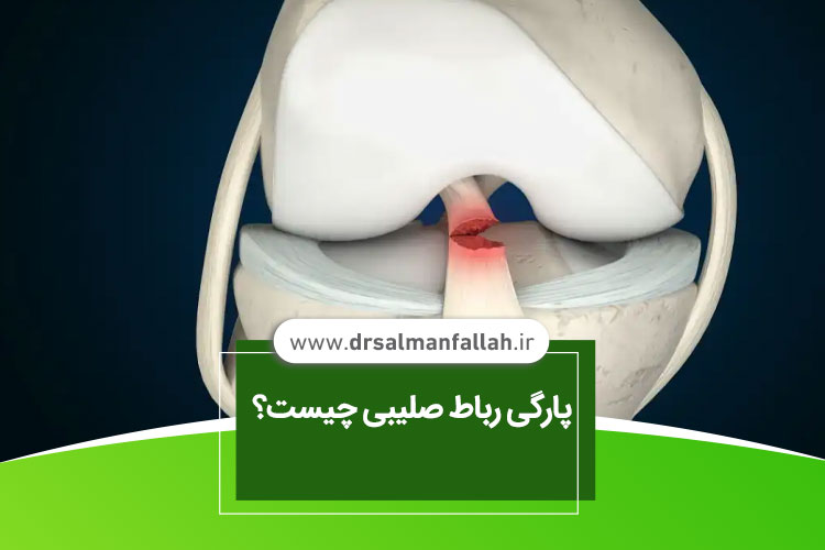 پارگی رباط صلیبی قدامی 