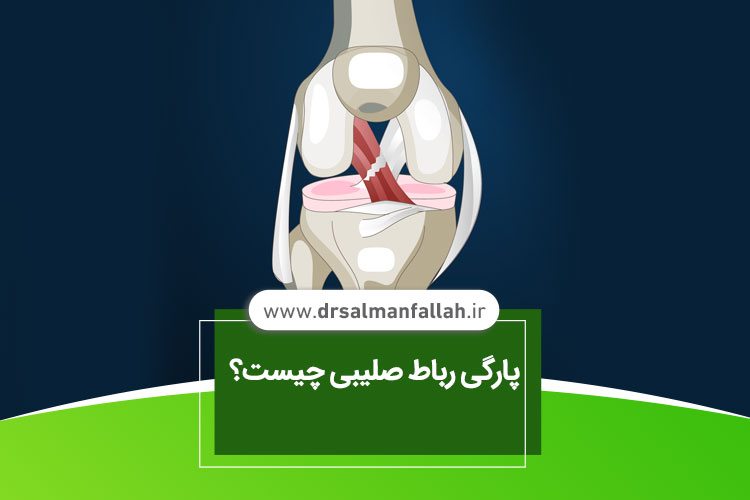 پارگی رباط صلیبی چیست