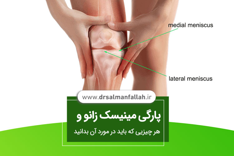 پارگی مینیسک زانو چیست؟