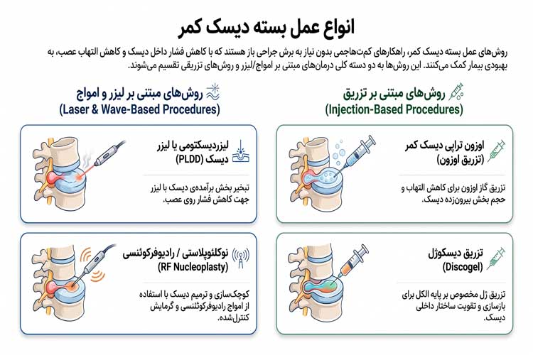 انواع عمل بسته دیسک کمر