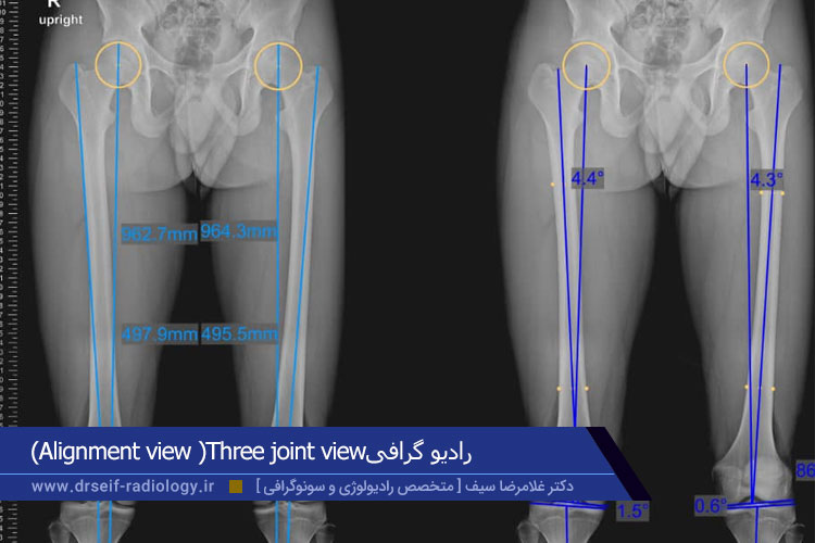 رادیوگرافی alignment view