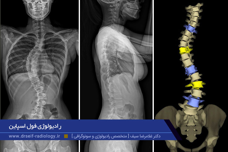 مزایای تصویربرداری فول اسپاین