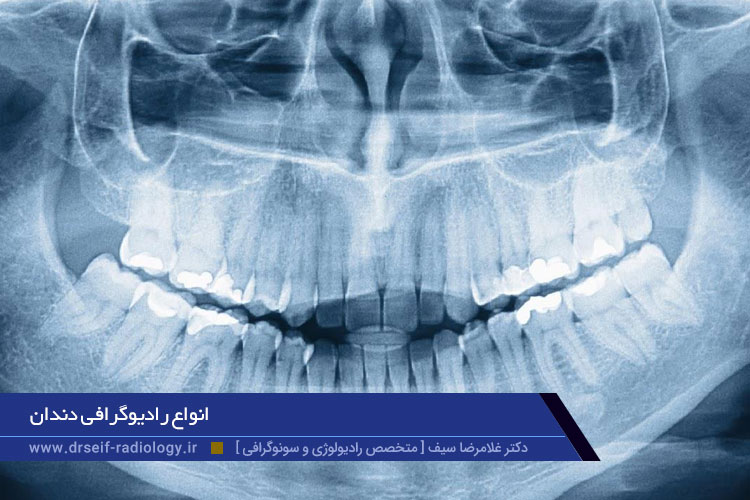 انواع رادیوگرافی دندان