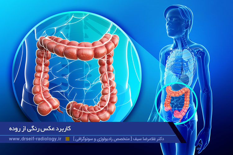 عکس رنگی از روده