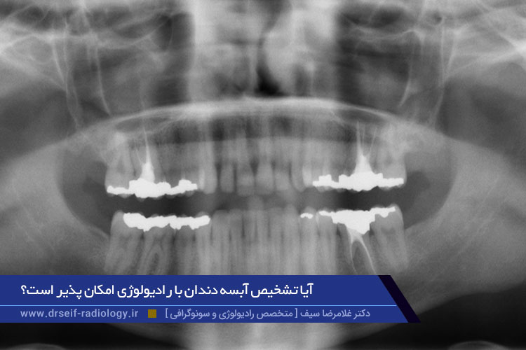 رادیولوژی دندان
