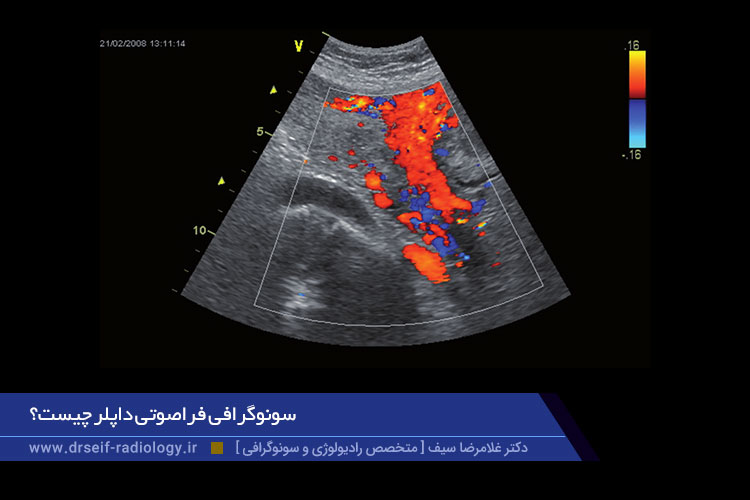 سونوگرافی فراصوتی