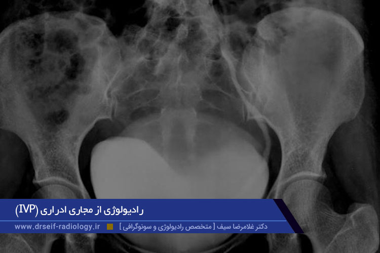 رادیولوژی از مجاری ادراری