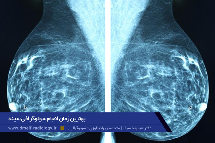 بهترین زمان انجام سونوگرافی سینه 