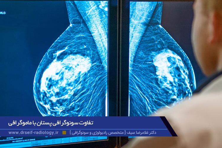 تفاوت سونوگرافی پستان با ماموگرافی