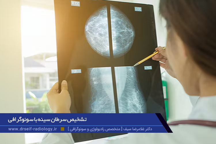 تشخيص سرطان سينه با سونوگرافی