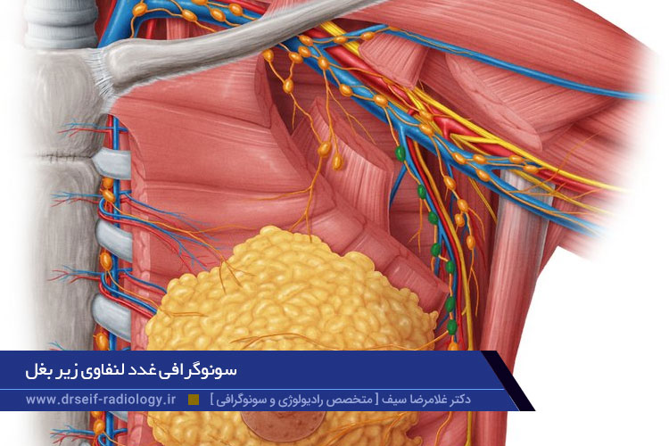 سونوگرافی زیر بغل