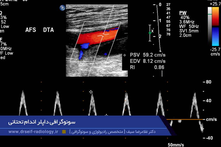 سونوگرافی داپلر اندام تحتانی