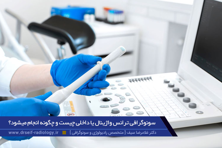 سونوگرافی ترانس واژینال