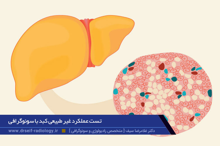 سونوگرافی عملکرد کبد