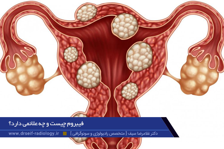فیبروم چیست