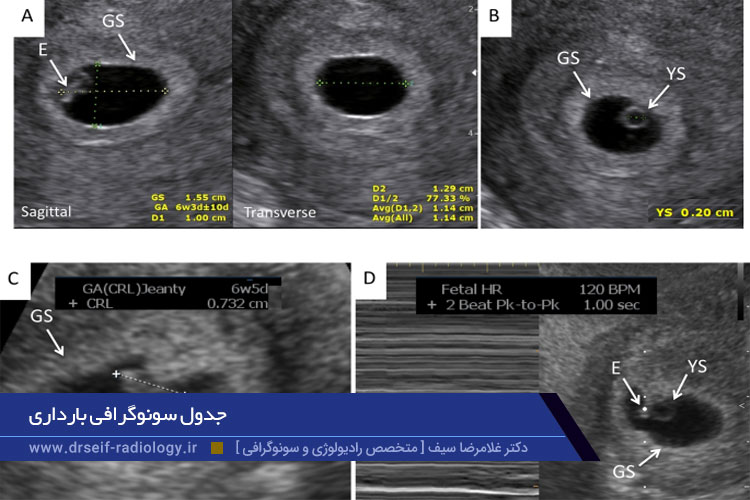 زمان بندی سونوگرافی های بارداری