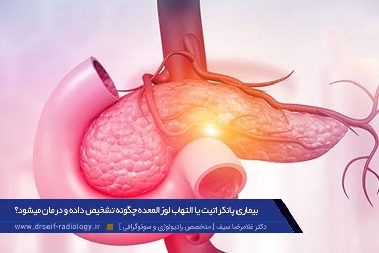 بیماری پانکراتیت یا التهاب لوزالمعده