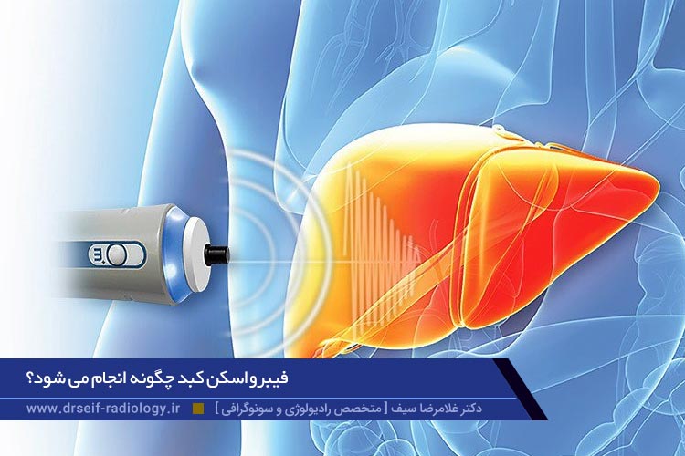 فیبرواسکن کبد