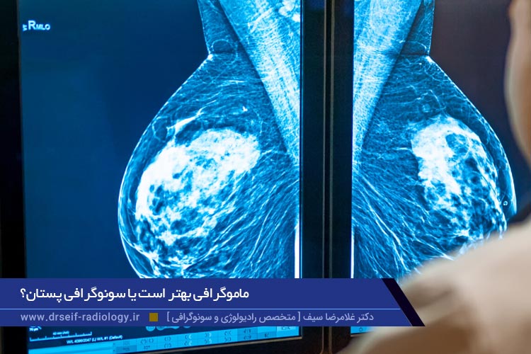 ماموگرافی بهتر است یا سونوگرافی پستان