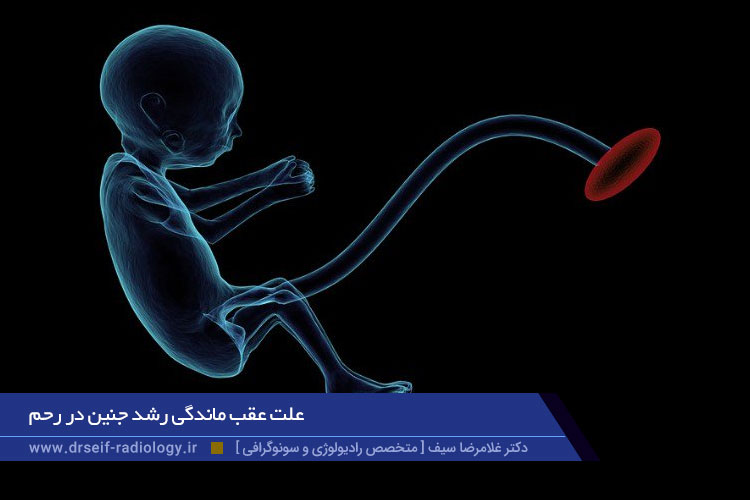 علت عقب ماندگی رشد جنین در رحم