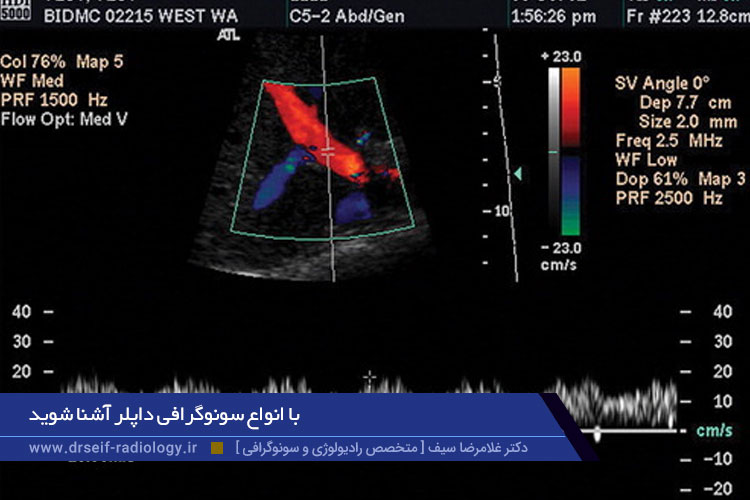 سونوگرافی داپلر 