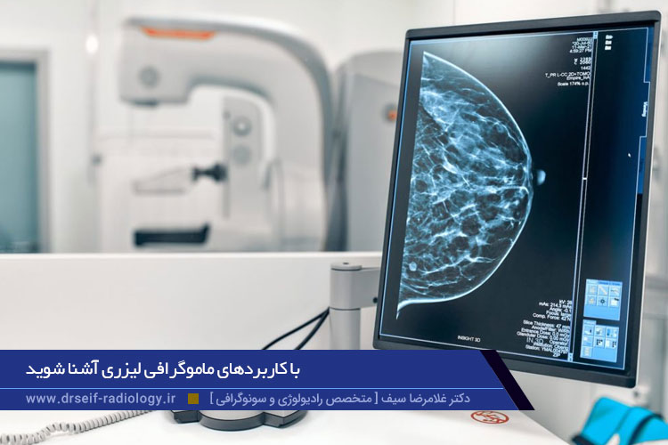 کاربردهای ماموگرافی لیزری