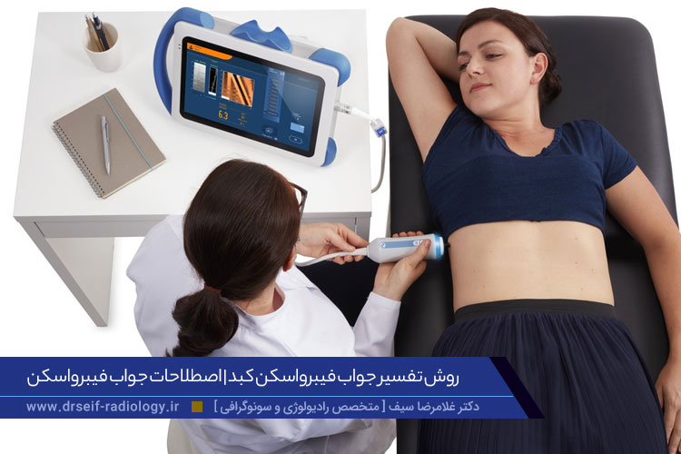 تفسیر جواب فیبرواسکن کبد