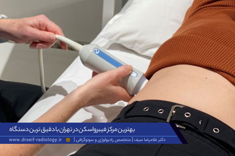 فیبرواسکن در تهران