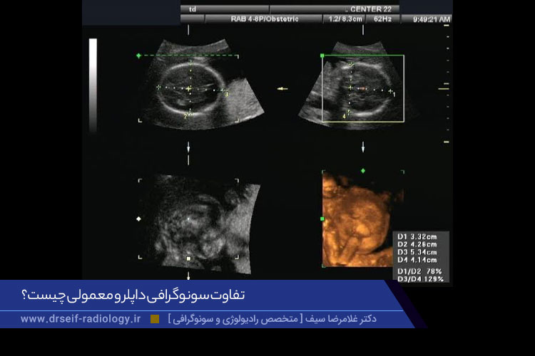 سونوگرافی داپلر و معمولی چه هستند؟