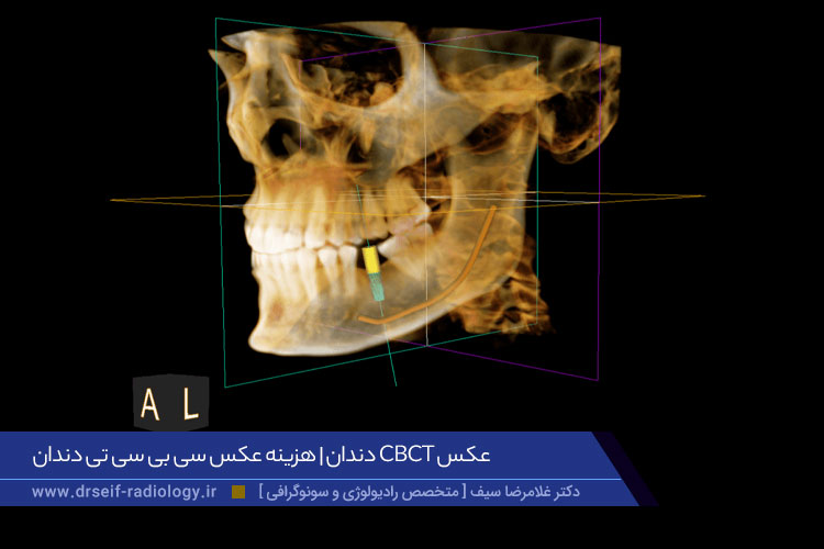 عکس سی بی سی تی دندان چیست؟