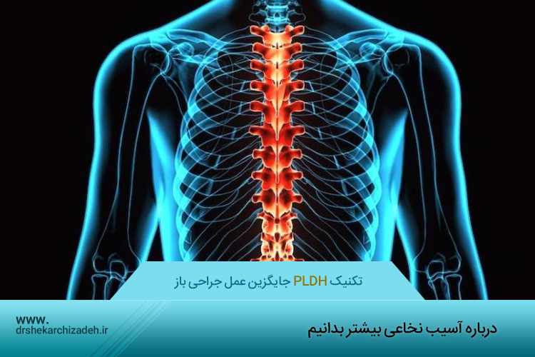 آسیب نخاعی