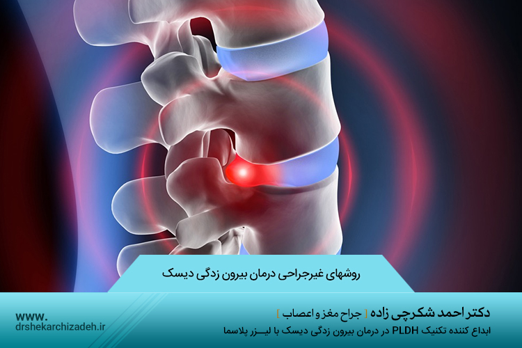 درمان بیرون زدگی دیسک