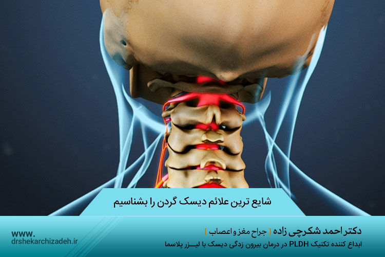 علائم دیسک گردن