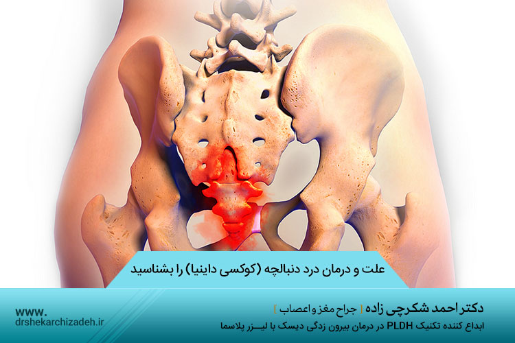 علت و درمان درد دنبالچه