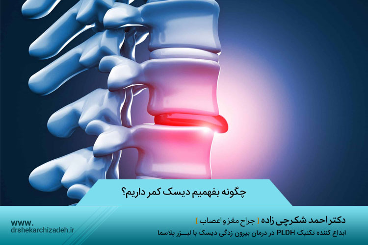 چگونه بفهمیم دیسک کمر داریم